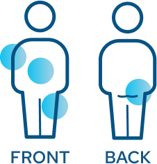 Injection sites on upper arm, stomach, upper leg, and buttocks