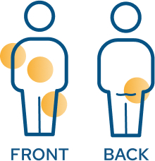 Injection sites on upper arm, stomach, upper leg, and buttocks